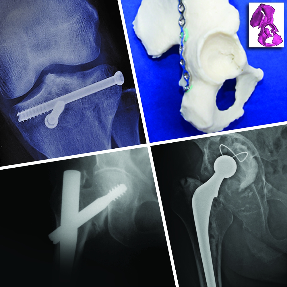 Orthopaedics and Traumatology