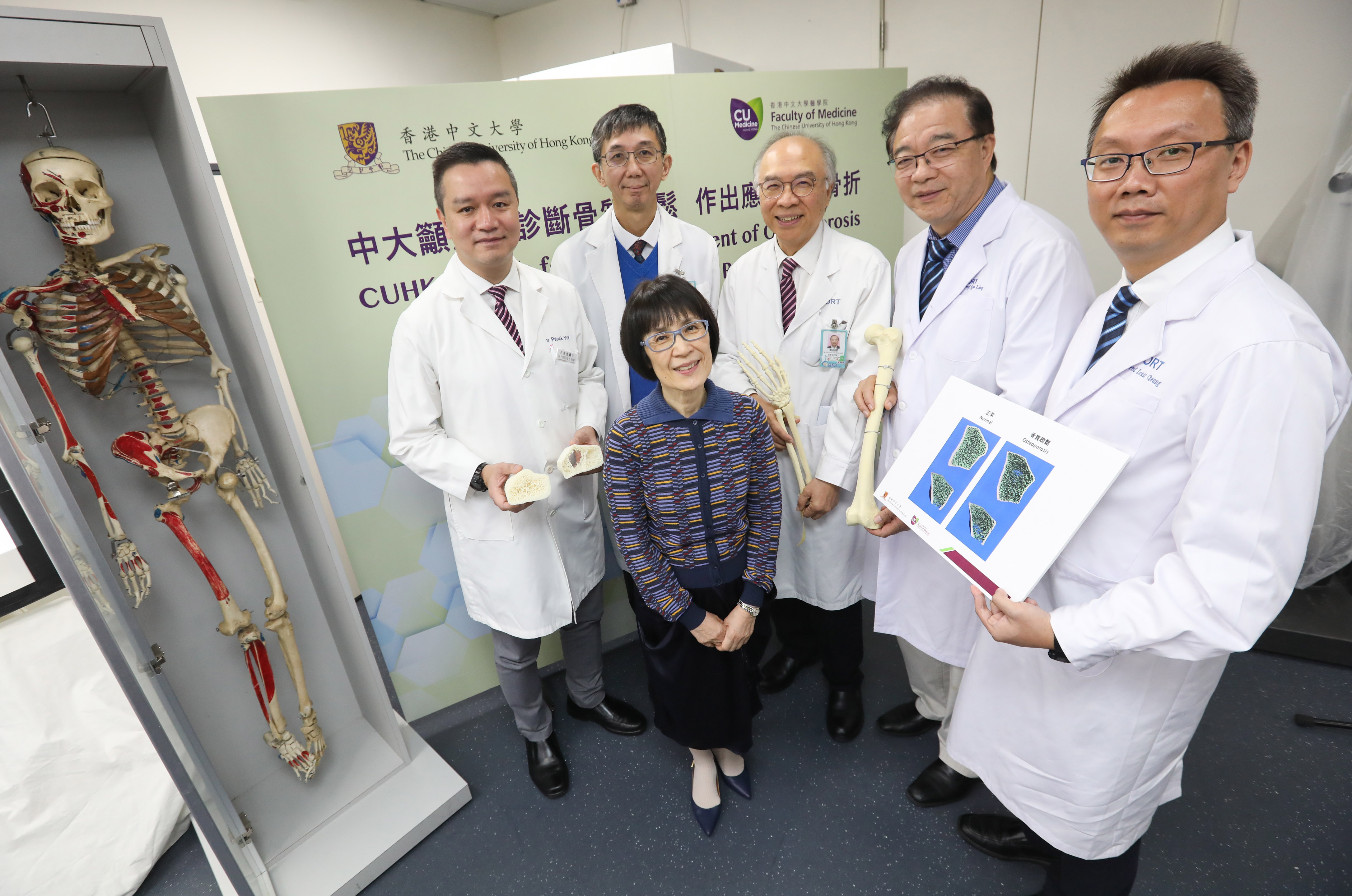 The Faculty of Medicine at CUHK has set the first 3D Bone Density Standard in Asia by using high-resolution peripheral quantitative computed tomography (HR-pQCT). (From left) Professor Patrick YUNG, Chairman of the Department of Orthopaedics and Traumatology; Professor Timothy KWOK, Director of the CUHK Jockey Club Centre for Osteoporosis Care and Control; Professor Fanny CHEUNG, Pro-Vice-Chancellor of CUHK; Professor Jack CHENG, CUHK Choh-Ming Li Research Professor of Orthopaedics and Traumatology; Professor Ling QIN and Professor Louis CHEUNG of the Department of Orthopaedics and Traumatology at CUHK Medicine. 