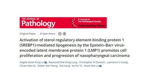 Therapeutic potential of lipogenesis inhibitors