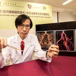 CUHK Proves Prostate Artery Embolization Effective for Benign Prostatic Hyperplasia