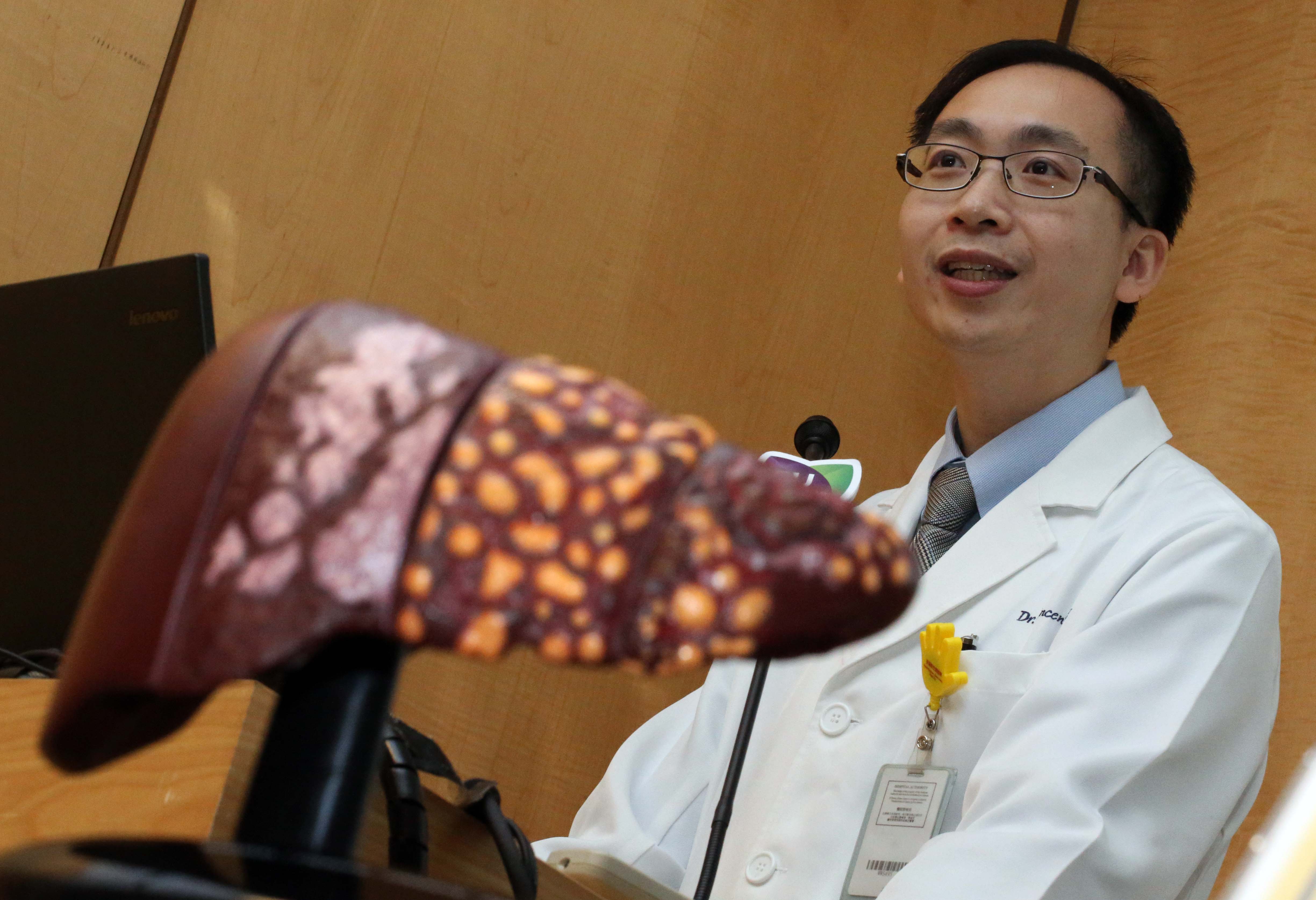 Dr. Vincent Wai Sun WONG says NAFLD 