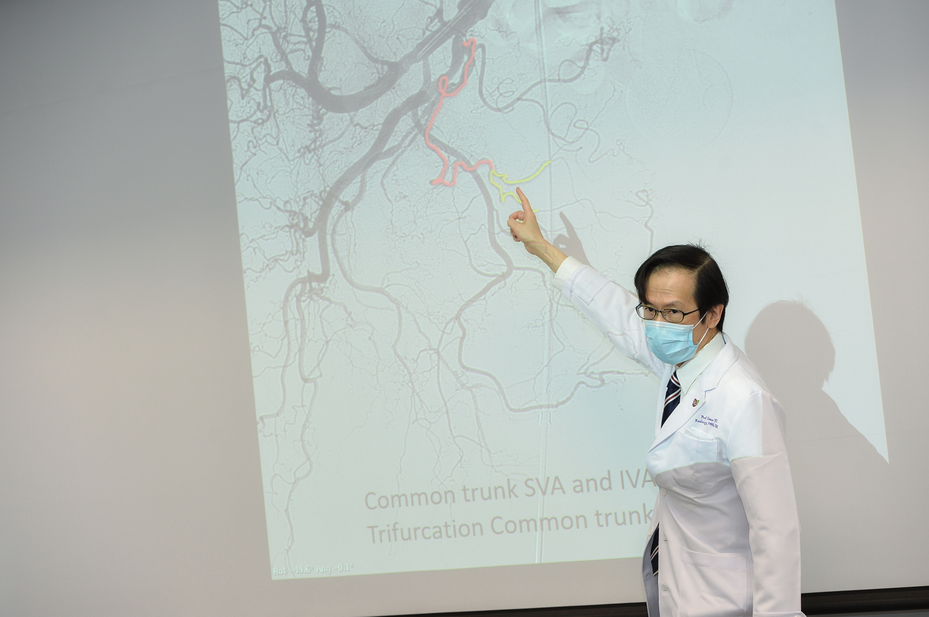 Professor Simon Yu states that results of the current study help to predict the treatment outcome of PAE before it is done and allow doctors to select the most appropriate treatment option for the greatest benefit of patients with BPH.