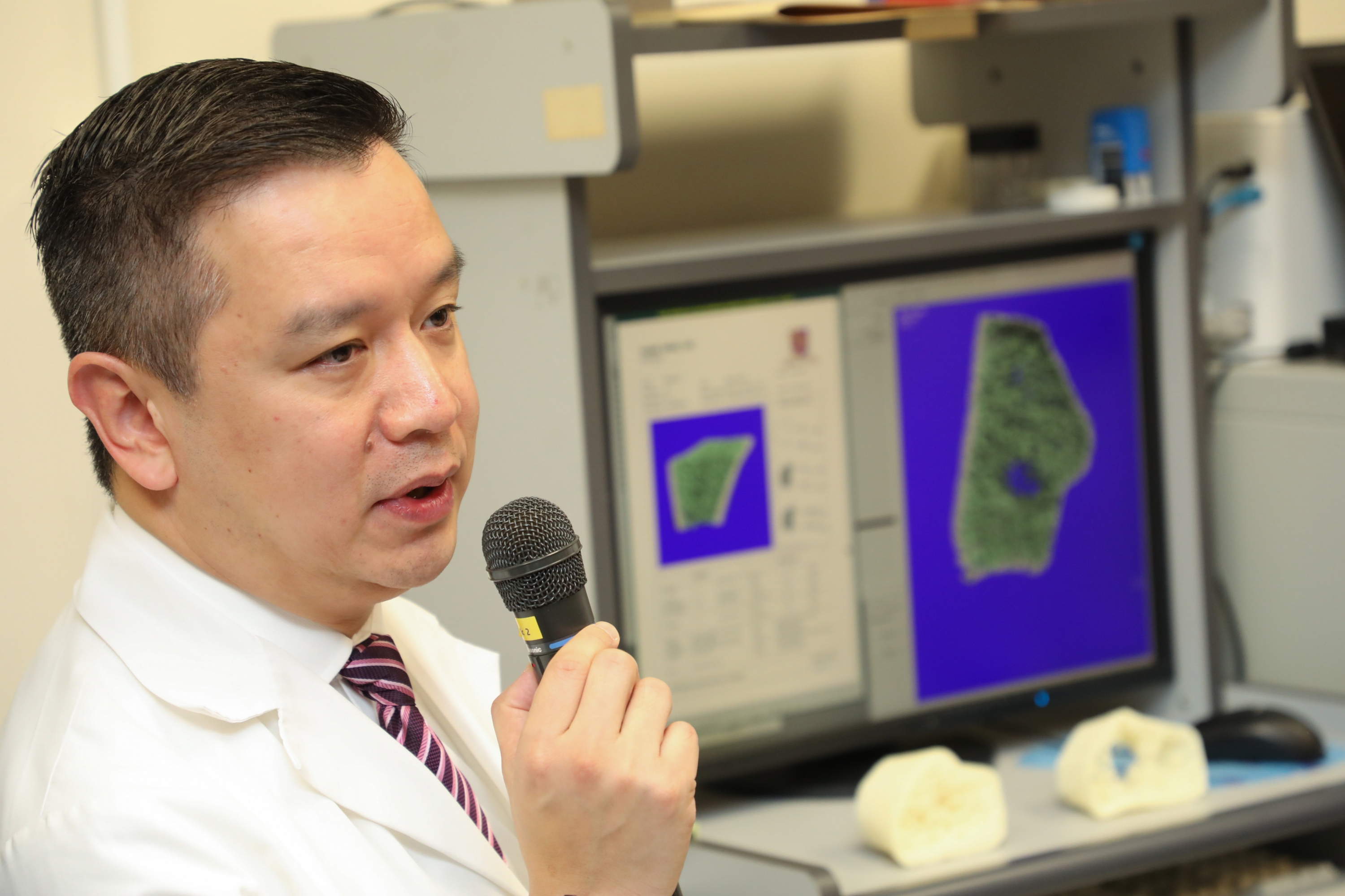 Professor Patrick YUNG, Chairman of the Department of Orthopaedics and Traumatology of the Faculty of Medicine at CUHK explains that HR-pQCT can perform precise analysis of the bone micro-architecture, thereby developing early diagnosis of osteoporosis.