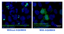 After adding AQAMAN, the polyQ protein aggregations are restored to normal protein.