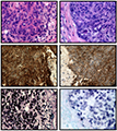 Establishment and Characterization of New Tumor Xenografts and Cancer Cell Lines from EBV-Positive Nasopharyngeal Carcinoma