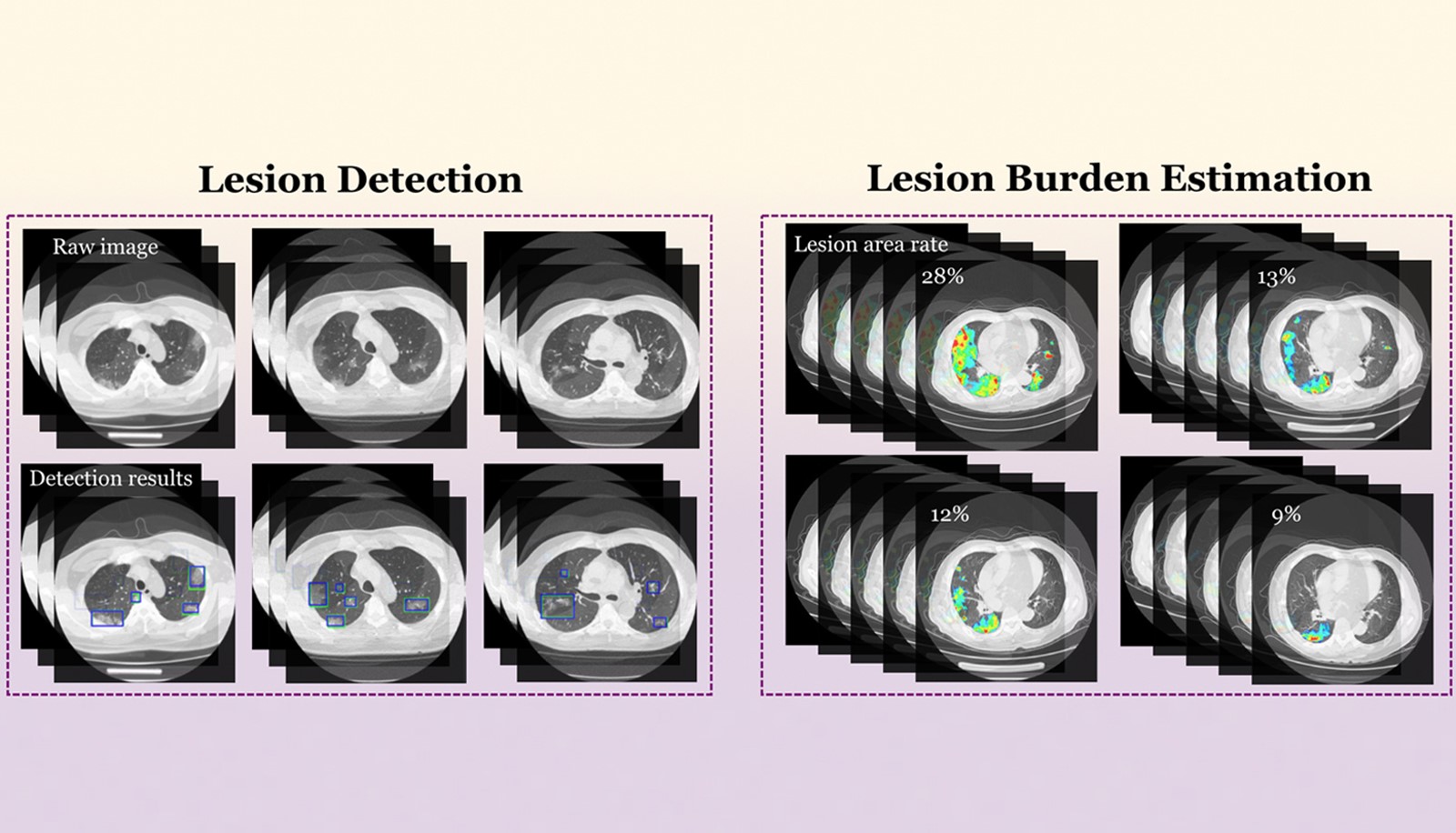 AI facilitates medical image analysis, speeding up the diagnosis of COVID-linked lung abnormalities.