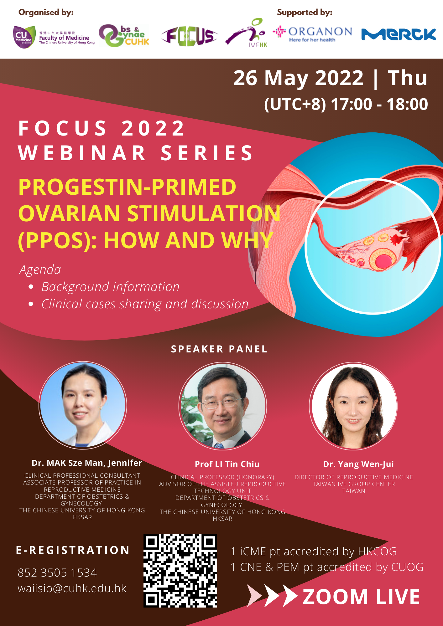 2022.05.26 FOCUS Webinar Series - Progestin-primed ovarian stimulation (PPOS): How and Why @ Webinar