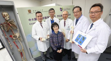 中大醫學院訂立亞洲首個「三維骨質量標準值」有助及早診斷骨質疏鬆及預防骨折