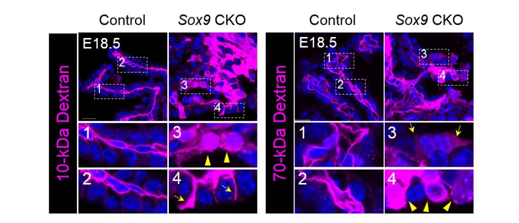 Fluorescent tracers penetrated choroid plexus epithelium in the SOX9 mutant, indicating leakiness of the blood-cerebrospinal fluid barrier.