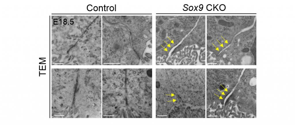 Transmission electron microscopy demonstrated the absence of tight junction structures in the SOX9 mutant choroid plexus epithelium.