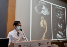 Professor Simon Chun Ho YU says PME device is convenient for point-of-care setting and with a much lower cost compared with CT scan or traditional transthoracic echocardiography. It is ideal for screening TAA patients and allows early intervention.