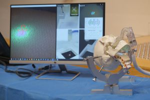 The newly developed magnetic-resonance-safe robotic system is in miniature size, with compliant architecture and five degrees of freedom, enabling safe and dexterous laser ablation within the confined spaces of the oral and pharyngeal cavities with intra-operative MRI guidance.