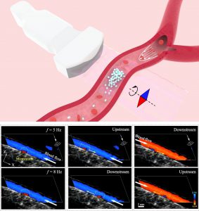 Ultrasound Doppler imaging-guided upstream navigation of a magnetic nanoparticle microswarm in flowing blood.