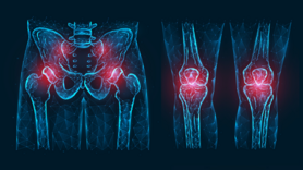 Joint Replacement Clinic