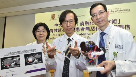 CUHK Study Proves Ablative Chemoembolization Doubles the Progression-Free Survival for Liver Cancer Patients