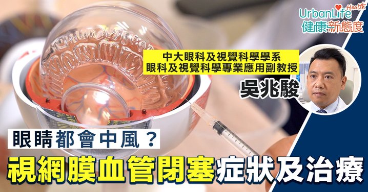 【眼中風前兆】眼睛都會中風？了解視網膜血管閉塞症狀及治療