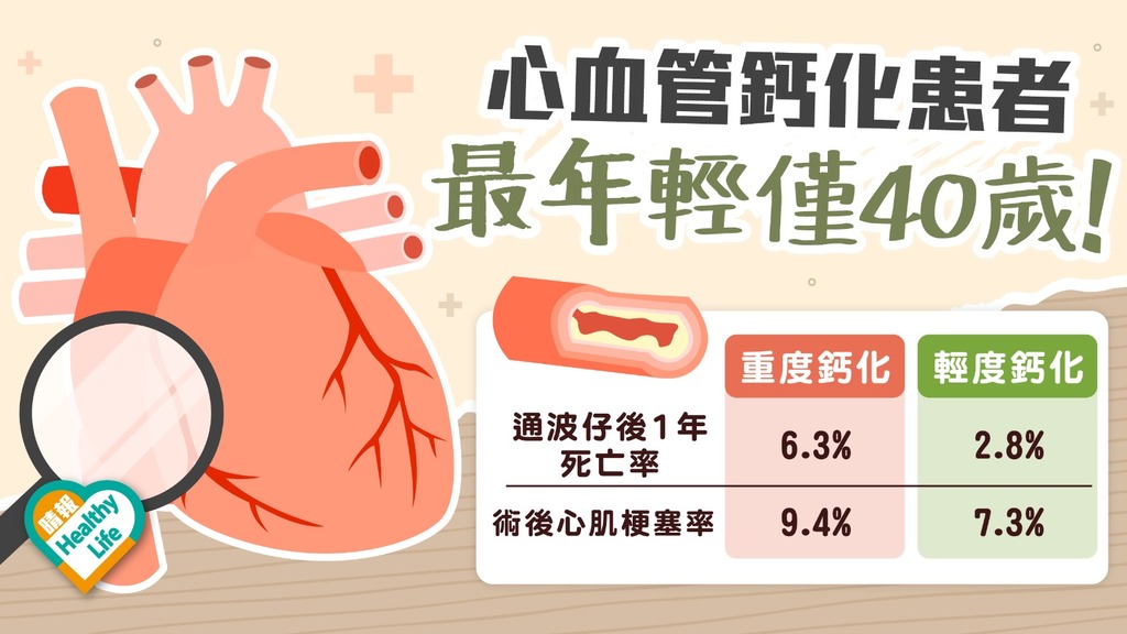 心臟健康｜嚴重心血管鈣化 如套「金剛圈」 礙冠心病患通波仔