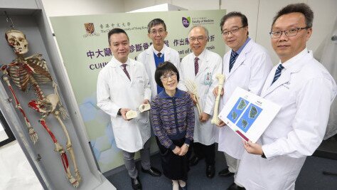 CUHK Sets Asia’s First Three-dimensional Bone Density Standard For Early Diagnosis of Osteoporosis and Fracture Prevention