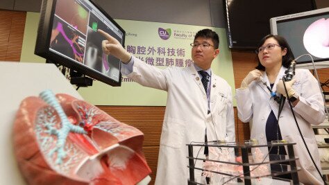 CUHK Pioneers Early Lung Cancer Treatment with Hybrid Operating Room Image Guided Electromagnetic Navigation Bronchoscopy