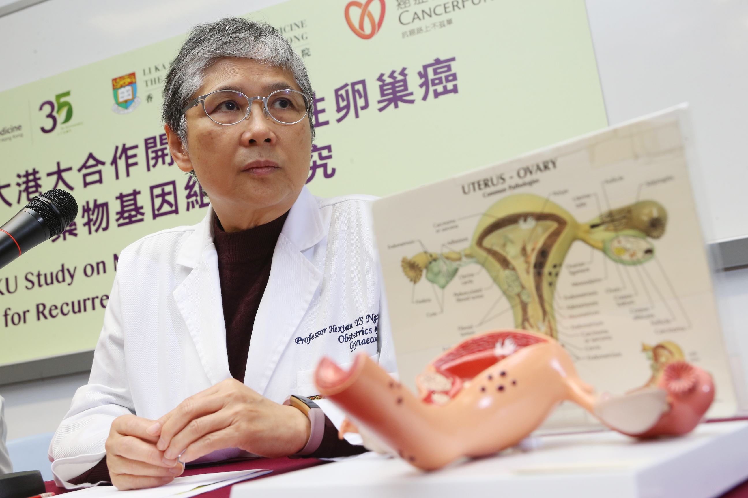 Professor NGAN says despite removal of all gross tumours, ovarian cancer recurrence can be up to 80% in late stage and therefore precise regimen is needed.