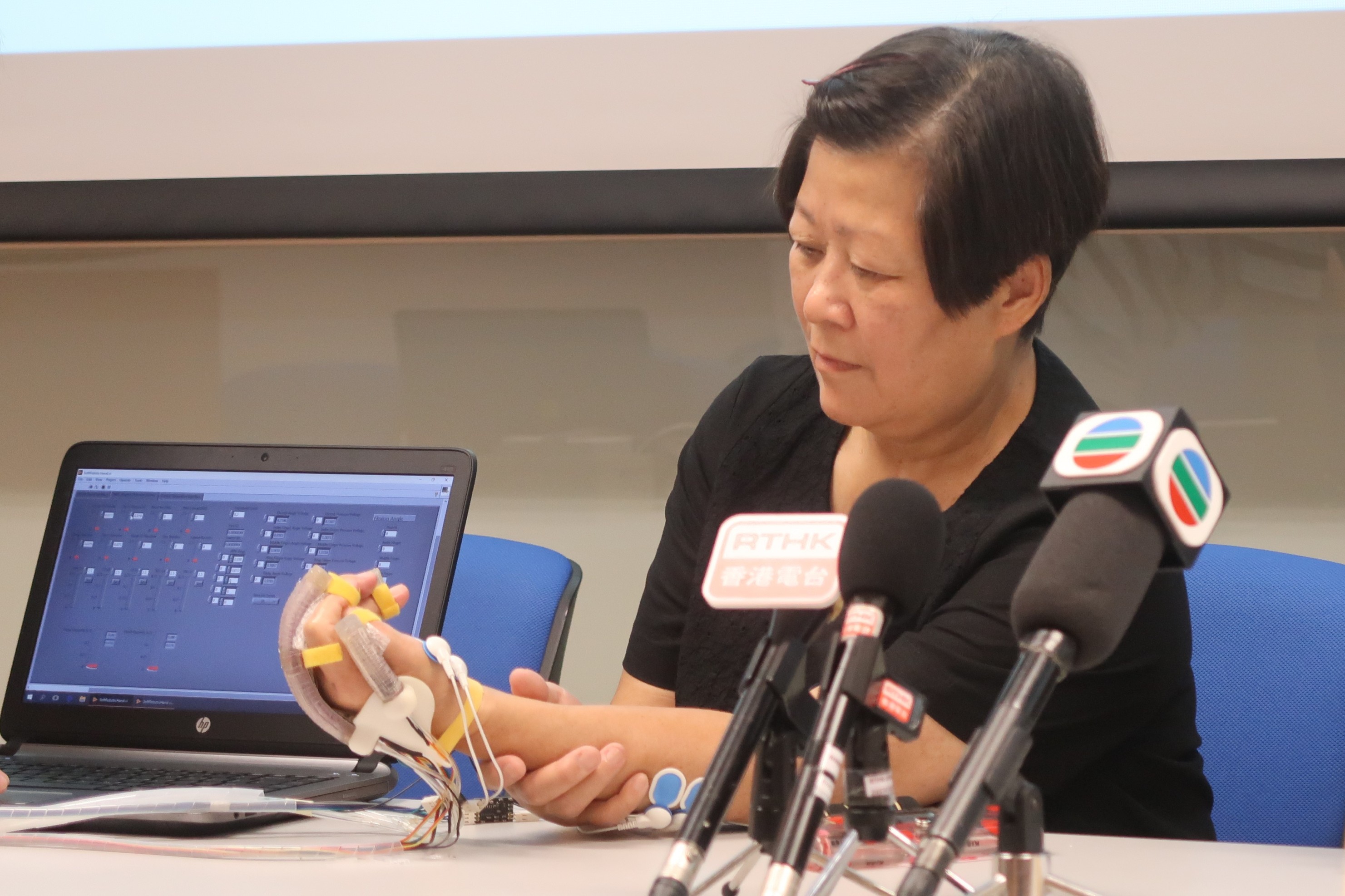 Ms. Chan, a stroke patient, demonstrates using the soft robotic hand for rehabilitation training.