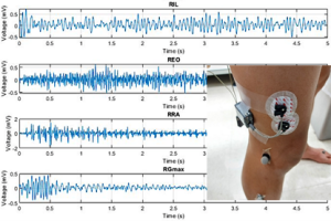 Noraxon Wireless EMG Sensors for Muscle Activity Measurement 