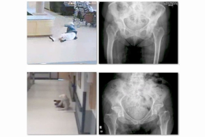 Mobility Patterns and Fall Mechanisms in Older Adults