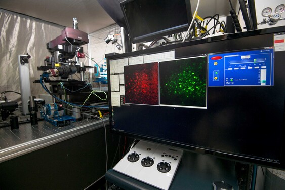 The Faculty has built the Hong Kong’s first in vivo multiphoton microscope dedicated to the study of cerebral small vessel disease. It will enhance the fundamental understanding of the underlying pathogenesis, the knowledge of which is crucial for the future development of novel therapeutics that can delay disease progression.<br />
