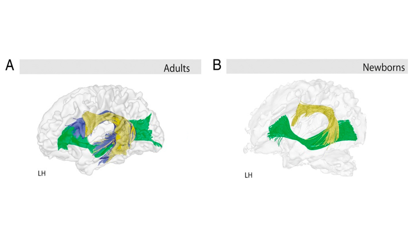 A picture of the adult vs the newborn brain
