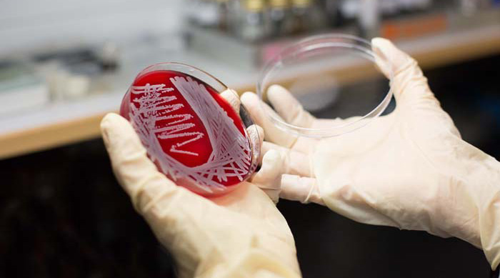 Laboratory Testing for MRSA