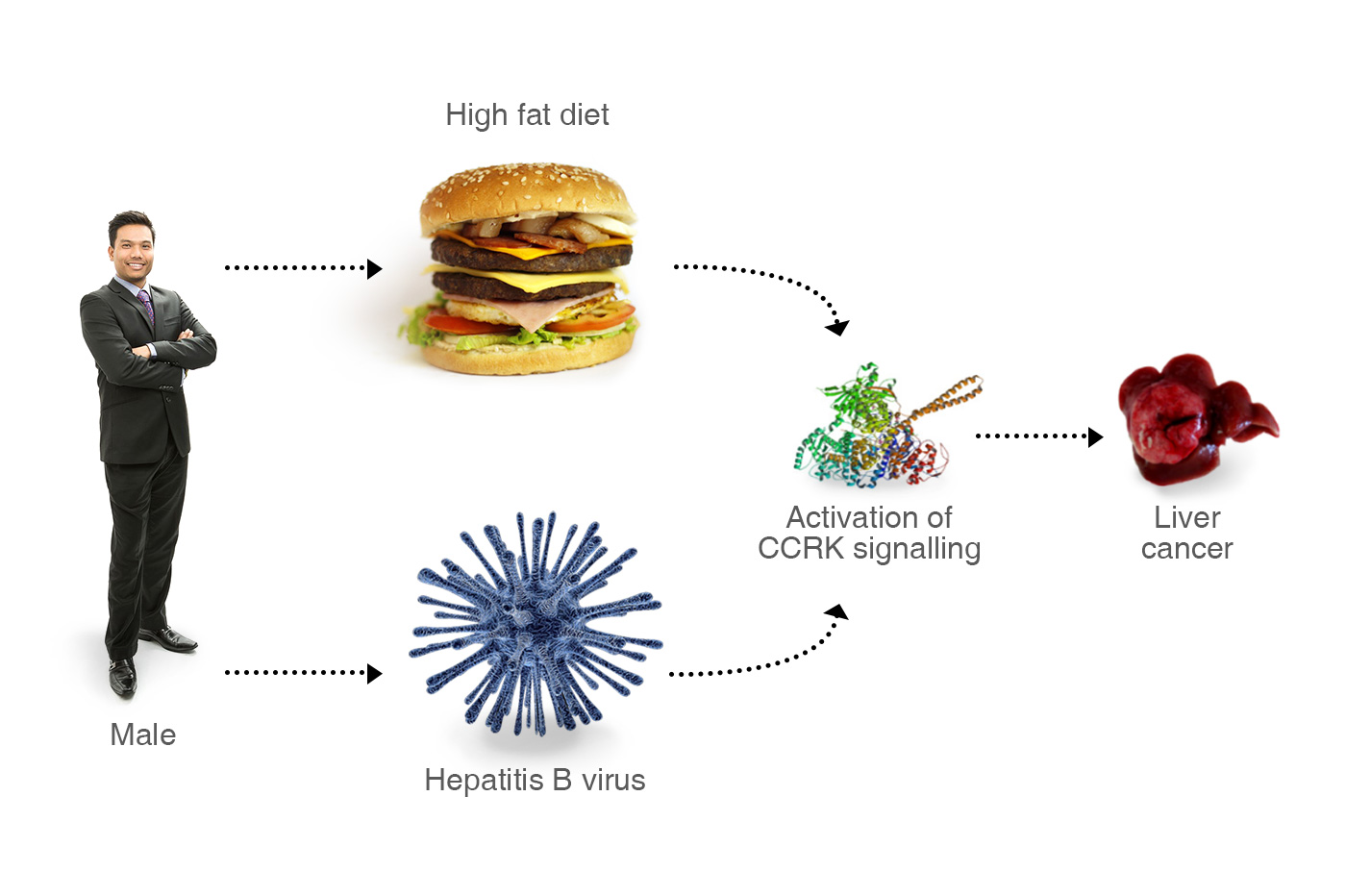 Why are men at a loss? Professor Cheng’s research team unveiled a male sex hormone-deregulated pathway that might contribute to liver cancer induced by either hepatitis virus or obesity