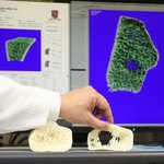 CUHK Sets Asia’s First Three-dimensional Bone Density Standard For Early Diagnosis of Osteoporosis and Fracture Prevention