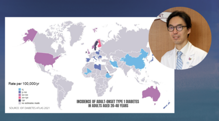 International study led by CU Medicine highlights significant global incidence of newly diagnosed type 1 diabetes among adults much higher than previously believed