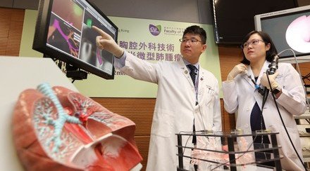 CUHK Pioneers Early Lung Cancer Treatment with Hybrid Operating Room Image Guided Electromagnetic Navigation Bronchoscopy