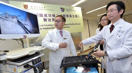 CUHK Succeeds in Treating Gastroesophageal Reflux Disease by Implantable Pulse Generator