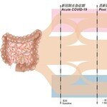 中大研究發現腸道微生態失衡與「長新冠」息息相關