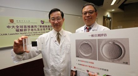 中大推全球首项运用「单细胞基因技术」检测卵子质素研究 破解卵子老化及女性不育之谜