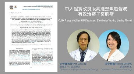 CUHK Proves Modified HIFU Treatment Effective for Treating Uterine Fibroids  