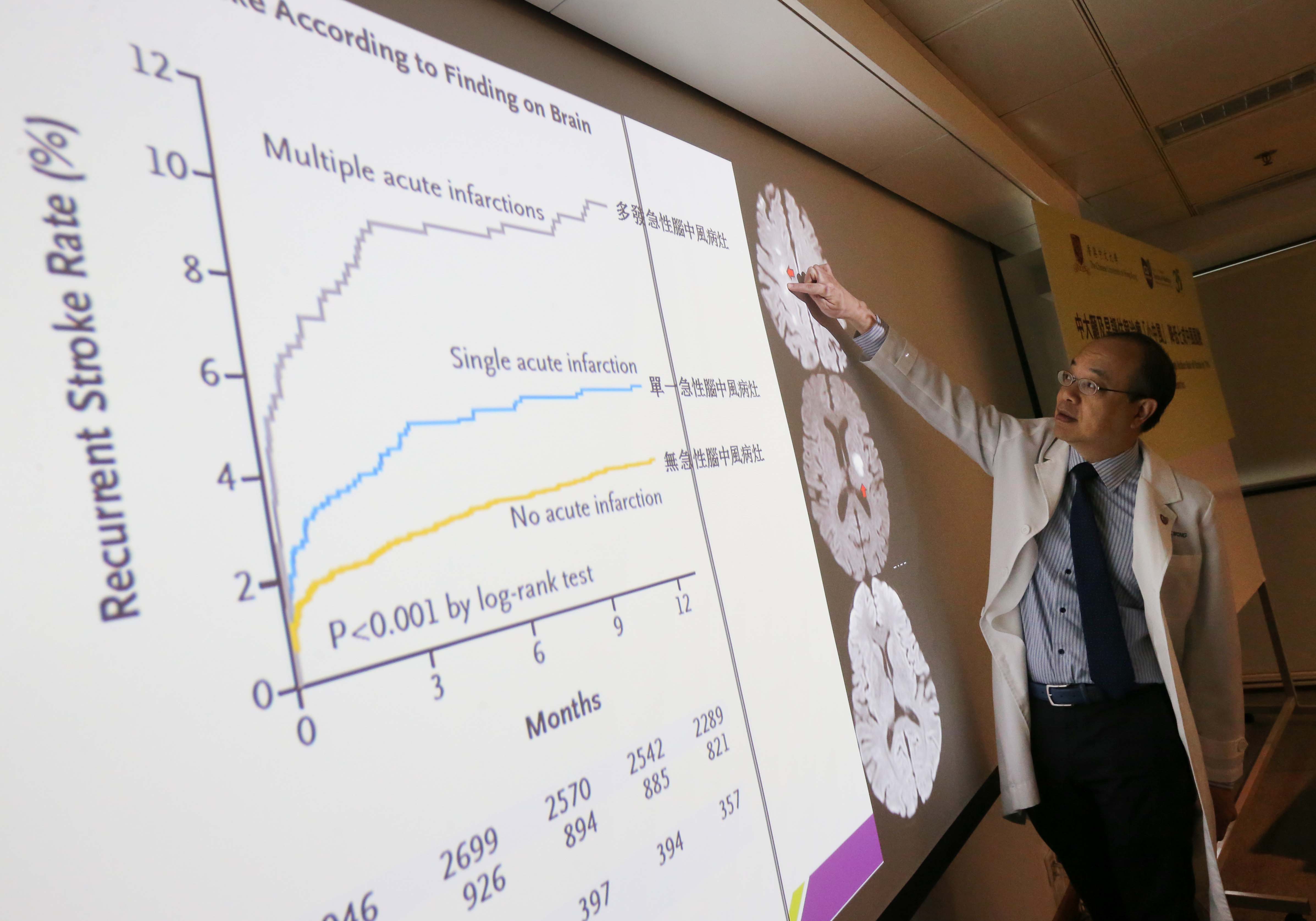 中大醫學院內科及藥物治療學系腦神經科主任黃家星教授