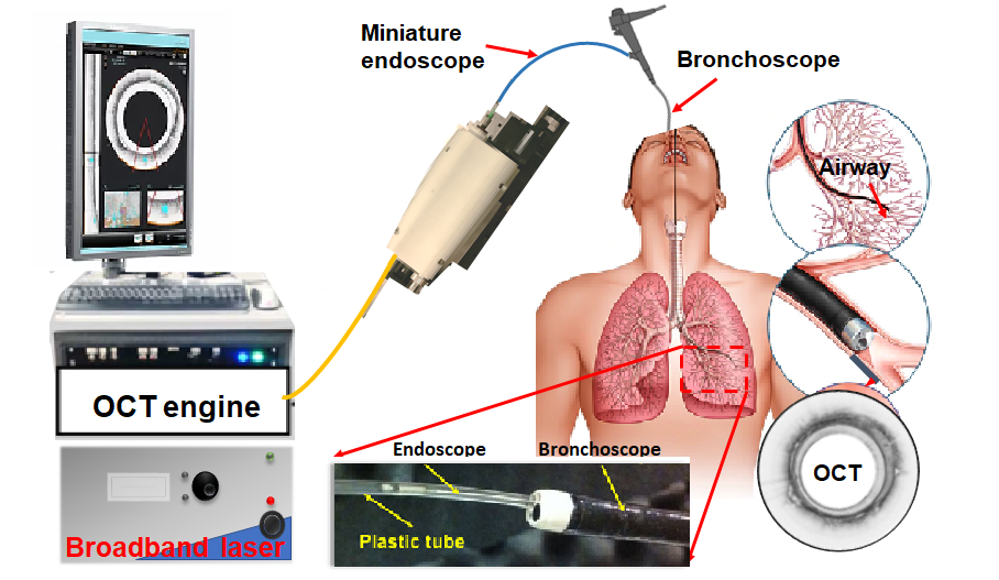 intraluminal imaging