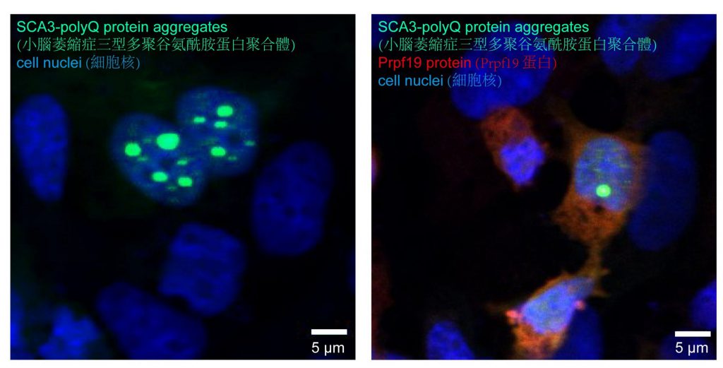 Prpf19 is capable of reducing the level of SCA3-polyQ protein aggregates.