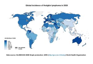 Global incidence of Hodgkin lymphoma in 2020