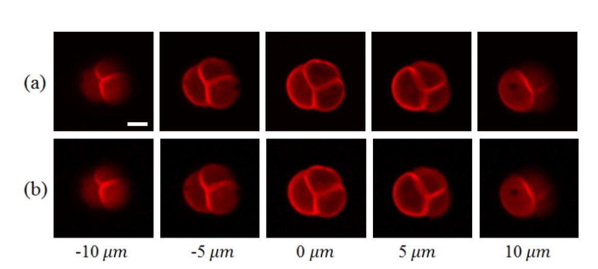 The researchers prepared two-photon microscopy images of a pollen grain by using (a) traditional point-scanning  and (b) the new compressive imaging approach. The point-scanning imaging time was 2.2 seconds while the compressive imaging time required only 0.55 seconds.