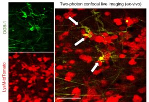 Two-photon confocal live imaging detected signalling (in yellow) from macrophage-derived neuronal-like cells (in red) in the lung tumour ex vivo.