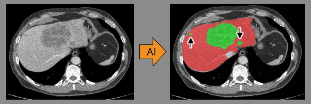 AI applications in medical image analysis