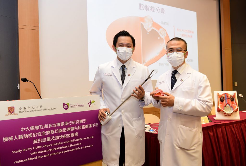 A study led by CU Medicine shows that robotic-assisted bladder removal with intracorporeal urinary diversion reduces the volume of blood loss and the length of hospital stay by 22% and 12% respectively. (From left) Dr. Jeremy TEOH, Assistant Professor from the Division of Urology, Department of Surgery at CU Medicine, and Professor Anthony NG, Professor from the Division of Urology, Department of Surgery at CU Medicine and Director of S.H. Ho Urology Centre at CUHK.