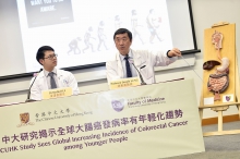 The latest research conducted by the gastroenterology team of the Faculty of Medicine and the Stanley Ho Big Data Decision Analytics Research Centre at CUHK reveals that the global incidence of colorectal cancer among younger individuals has been marked by a continual increase. Research team members include Professor Joseph SUNG (right), Mok Hing Yiu Professor of Medicine, and Dr. Rashid LUI, Clinical Tutor (honorary) of Department of Medicine and Therapeutics in Faculty of Medicine at CUHK.