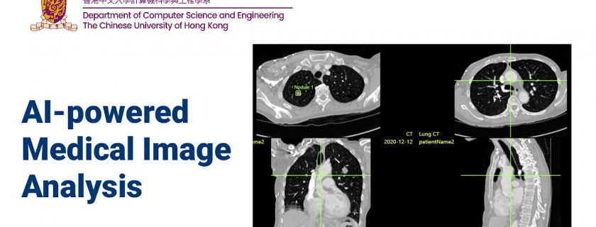 AI-powered Medical Image Analysis