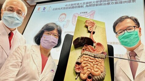 中大聯同港大及倫敦大學學院破解基因突變引致先天性巨結腸症機制 為開發嶄新治療方案提供線索