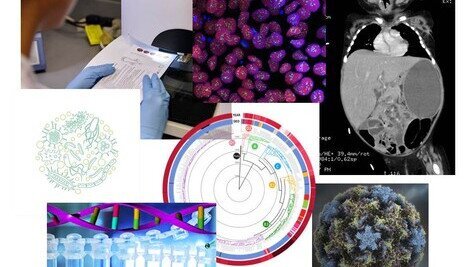 「香港中文大学卓越儿童健康研究所」正式成立 结合全球跨学科力量 促进儿童健康和福祉